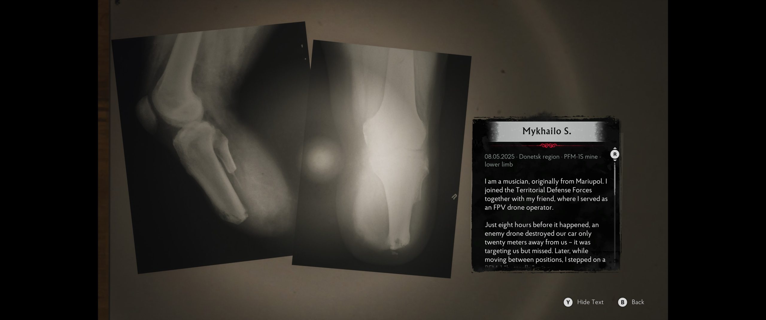 In-game medical case record featuring Mykhailo S. and wartime trauma narrative