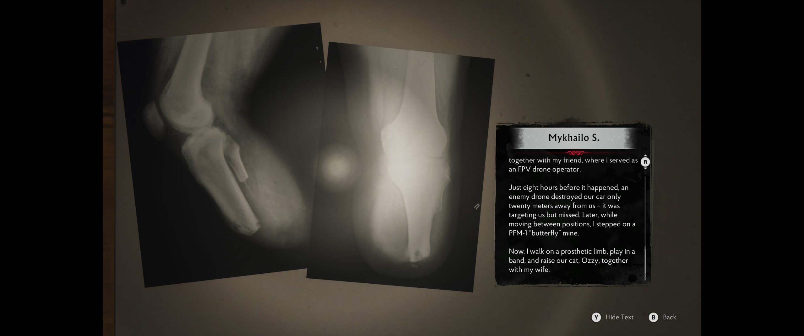 Detailed X-ray documentation and personal story entry
